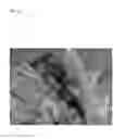 Fig. 13 - Pathogen for bacterial poultry disease