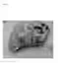 Fig. 18 - Pathogen for bacterial poultry disease