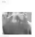 Fig. 23 - Pathogen for bacterial poultry disease
