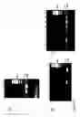 Fig. 03 - Methods and compositions for increasing tissue tropism of recombinant adenoviral vectors