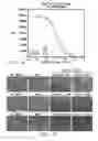Fig. 04 - METHODS AND COMPOSITIONS FOR TREATING AND DIAGNOSING KIDNEY DISEASE