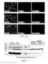 Fig. 05 - METHODS AND COMPOSITIONS FOR TREATING AND DIAGNOSING KIDNEY DISEASE