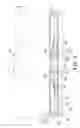 Fig. 05 - SURFACE TREATING METHOD FOR PROBE CARD IN VACUUM DEPOSITION DEVICE