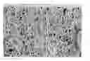 Fig. 01 - Fiber comprising unmodified and/or modified starch and a crosslinking agent