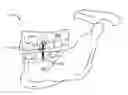 Fig. 01 - Apparatus, system, and method for maxillo-mandibular fixation