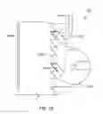 Fig. 11 - Apparatus, system, and method for maxillo-mandibular fixation