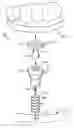 Fig. 01 - Apparatus, system, and method for implanting dental prosthesis