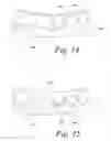 Fig. 17 - Methods for manufacturing dental implant components