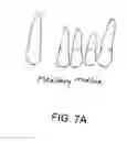 Fig. 18 - Method for tooth implants
