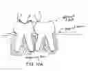Fig. 23 - Method for tooth implants