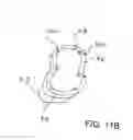 Fig. 27 - Method for tooth implants