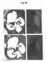 Fig. 03 - METHODS OF DIAGNOSING CARDIOVASCULAR DISEASE