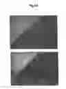 Fig. 05 - METHODS OF DIAGNOSING CARDIOVASCULAR DISEASE
