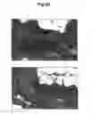 Fig. 06 - METHODS OF DIAGNOSING CARDIOVASCULAR DISEASE