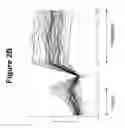 Fig. 04 - Tissue Rejection