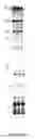 Fig. 18 - Compositions and methods of a phosphatidic acid binding protein