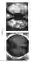 Fig. 10 - BIO SURFACE ACOUSTIC WAVE (SAW) RESONATOR AMPLIFICATION WITH NANOPARTICLES FOR DETECTION OF A TARGET ANALYTE