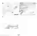 Fig. 07 -  METHOD FOR DIAGNOSING ATHEROSCLEROTIC PLAQUES BY MEASUREMENT OF CD36