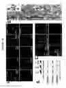 Fig. 11 - Methods of Identifying Disease Biomarkers in the Lense of the Eye