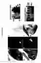 Fig. 15 - Methods of Identifying Disease Biomarkers in the Lense of the Eye