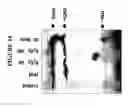 Fig. 25 - Methods of Identifying Disease Biomarkers in the Lense of the Eye