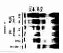 Fig. 26 - Methods of Identifying Disease Biomarkers in the Lense of the Eye