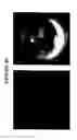 Fig. 27 - Methods of Identifying Disease Biomarkers in the Lense of the Eye