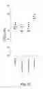 Fig. 13 - NUCLEIC ACID COMPOUNDS FOR INHIBITING GENE EXPRESSION AND USES THEREOF