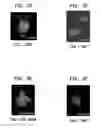 Fig. 04 - CANCER STEM CELLS AND USES THEREOF
