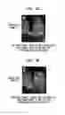 Fig. 09 - CANCER STEM CELLS AND USES THEREOF