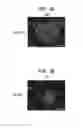 Fig. 20 - CANCER STEM CELLS AND USES THEREOF