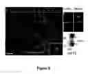 Fig. 10 - Methods of Inhibiting Tumor Cell Aggressiveness Using the Microenvironment of Human Embryonic Stem Cells