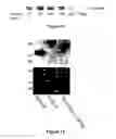 Fig. 15 - Methods of Inhibiting Tumor Cell Aggressiveness Using the Microenvironment of Human Embryonic Stem Cells