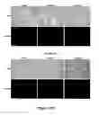 Fig. 18 - Methods of Inhibiting Tumor Cell Aggressiveness Using the Microenvironment of Human Embryonic Stem Cells