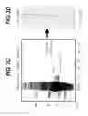 Fig. 05 - METHOD OF TREATING RESPIRATORY DISORDERS