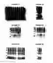 Fig. 15 - Nucleic acids and proteins from groups A & B