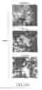 Fig. 33 - Method for detecting neuroblastoma