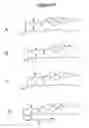 Fig. 04 - LIPID NANOPARTICLE BASED COMPOSITIONS AND METHODS FOR THE DELIVERY OF BIOLOGICALLY ACTIVE MOLECULES