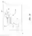 Fig. 17 - Method for providing phototherapy to the brain
