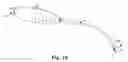 Fig. 14 - Surgical needle and anchor system with retractable features