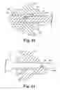 Fig. 17 - Surgical needle and anchor system with retractable features