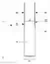 Fig. 04 - Motor and endoscope probe equipped with motor