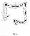 Fig. 03 - SYSTEM AND METHOD FOR NAVIGATING A TOOL WITHIN A BODY CONDUIT