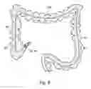 Fig. 06 - SYSTEM AND METHOD FOR NAVIGATING A TOOL WITHIN A BODY CONDUIT