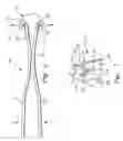 Fig. 04 - Surgical retractor extensions