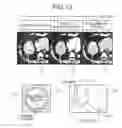 Fig. 15 - Image display apparatus, image display method, and magnetic resonance imaging apparatus