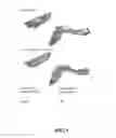 Fig. 04 - CAROTID PLAQUE IDENTIFICATION METHOD