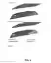 Fig. 05 - CAROTID PLAQUE IDENTIFICATION METHOD