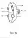 Fig. 14 - Compact diagnostic neurological tool