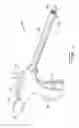 Fig. 02 - SURGICAL RETRACTOR